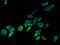 Transmembrane 4 L Six Family Member 1 antibody, A61330-100, Epigentek, Immunofluorescence image 