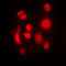 Eukaryotic Translation Initiation Factor 2 Alpha Kinase 2 antibody, LS-C352730, Lifespan Biosciences, Immunofluorescence image 