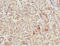 BCL2 Interacting Protein 1 antibody, LS-C682089, Lifespan Biosciences, Immunohistochemistry paraffin image 