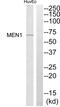 Menin 1 antibody, abx014044, Abbexa, Western Blot image 