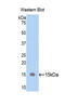 Thy-1 Cell Surface Antigen antibody, LS-C296635, Lifespan Biosciences, Western Blot image 