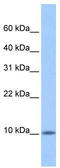 Chromosome 20 Open Reading Frame 141 antibody, TA340247, Origene, Western Blot image 