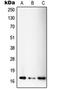 Single Stranded DNA Binding Protein 1 antibody, LS-C352872, Lifespan Biosciences, Western Blot image 