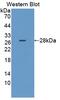 DNA Methyltransferase 3 Beta antibody, abx131181, Abbexa, Western Blot image 