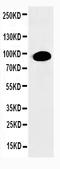 Protein Kinase C Alpha antibody, PA1065, Boster Biological Technology, Western Blot image 