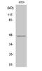 Inositol Polyphosphate Multikinase antibody, A06955-1, Boster Biological Technology, Western Blot image 