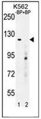 DEP Domain Containing 5 antibody, AP51242PU-N, Origene, Western Blot image 