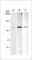 Tumor Protein P73 antibody, PM4851, ECM Biosciences, Western Blot image 