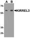 Kirre Like Nephrin Family Adhesion Molecule 3 antibody, A07202, Boster Biological Technology, Western Blot image 