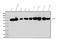 Glycine dehydrogenase [decarboxylating], mitochondrial antibody, A04777-2, Boster Biological Technology, Western Blot image 
