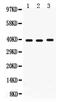 Midkine antibody, RP1051, Boster Biological Technology, Western Blot image 