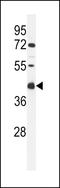 Transmembrane Protein 268 antibody, LS-C168775, Lifespan Biosciences, Western Blot image 