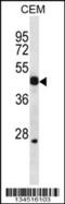 WNT Inhibitory Factor 1 antibody, 57-817, ProSci, Western Blot image 