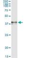 Coagulation Factor III, Tissue Factor antibody, H00002152-M01, Novus Biologicals, Immunoprecipitation image 