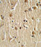 Heat Shock Protein Family A (Hsp70) Member 8 antibody, LS-C165067, Lifespan Biosciences, Immunohistochemistry paraffin image 