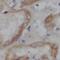 Cell Cycle Regulator Of NHEJ antibody, FNab01136, FineTest, Immunohistochemistry paraffin image 