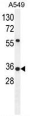 Sosondowah Ankyrin Repeat Domain Family Member D antibody, AP50189PU-N, Origene, Western Blot image 