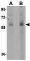 Scavenger Receptor Class B Member 1 antibody, GTX31791, GeneTex, Western Blot image 