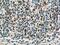 Toll Like Receptor 3 antibody, 17766-1-AP, Proteintech Group, Immunohistochemistry paraffin image 
