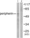 Peripherin antibody, abx013177, Abbexa, Western Blot image 