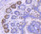 Platelet Derived Growth Factor Receptor Alpha antibody, GTX01102, GeneTex, Immunohistochemistry paraffin image 