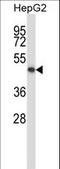 Potassium Two Pore Domain Channel Subfamily K Member 10 antibody, LS-C165439, Lifespan Biosciences, Western Blot image 