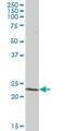 Phosphatidylcholine Transfer Protein antibody, H00058488-B01P, Novus Biologicals, Western Blot image 