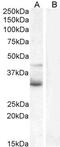 Wnt Family Member 4 antibody, GTX15699, GeneTex, Western Blot image 