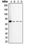 Transforming Growth Factor Beta Receptor 2 antibody, LS-C352935, Lifespan Biosciences, Western Blot image 