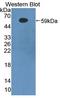 Beta-Secretase 1 antibody, LS-C372590, Lifespan Biosciences, Western Blot image 