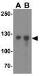 Regulatory Factor X1 antibody, GTX31948, GeneTex, Western Blot image 