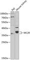 ACTH receptor antibody, 18-905, ProSci, Western Blot image 