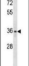 Lymphatic Vessel Endothelial Hyaluronan Receptor 1 antibody, PA5-11873, Invitrogen Antibodies, Western Blot image 