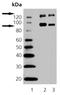 Discs Large MAGUK Scaffold Protein 1 antibody, ADI-VAM-PS005-F, Enzo Life Sciences, Western Blot image 