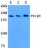 Phospholipase C Beta 3 antibody, PA5-75210, Invitrogen Antibodies, Western Blot image 