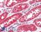 Fibroblast Growth Factor Receptor 4 antibody, LS-B3617, Lifespan Biosciences, Immunohistochemistry paraffin image 