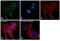 Protein Kinase C Alpha antibody, PA5-17551, Invitrogen Antibodies, Immunofluorescence image 