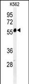 Folate Hydrolase 1B antibody, A15227-1, Boster Biological Technology, Western Blot image 