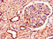 SMAD Specific E3 Ubiquitin Protein Ligase 1 antibody, CSB-PA875720LA01HU, Cusabio, Immunohistochemistry paraffin image 