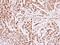 Minichromosome Maintenance Complex Component 4 antibody, NBP1-33105, Novus Biologicals, Immunohistochemistry paraffin image 