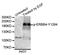 Erb-B2 Receptor Tyrosine Kinase 4 antibody, LS-C335737, Lifespan Biosciences, Western Blot image 