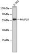 Matrix Metallopeptidase 19 antibody, 19-228, ProSci, Western Blot image 