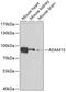 ADAM Metallopeptidase Domain 15 antibody, 23-160, ProSci, Western Blot image 