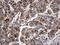 Glucosylceramidase Beta antibody, MA5-26589, Invitrogen Antibodies, Immunohistochemistry frozen image 