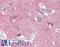 Clathrin Heavy Chain antibody, LS-B15424, Lifespan Biosciences, Immunohistochemistry paraffin image 