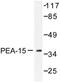 Proliferation And Apoptosis Adaptor Protein 15 antibody, LS-C176448, Lifespan Biosciences, Western Blot image 