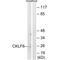 CKLF Like MARVEL Transmembrane Domain Containing 6 antibody, MBS9411705, MyBioSource, Western Blot image 