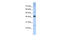 Basic Leucine Zipper ATF-Like Transcription Factor antibody, 25-090, ProSci, Western Blot image 