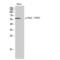 Checkpoint Kinase 2 antibody, LS-C381137, Lifespan Biosciences, Western Blot image 