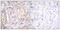B-Raf Proto-Oncogene, Serine/Threonine Kinase antibody, abx012468, Abbexa, Immunohistochemistry paraffin image 